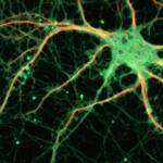 Brain cells in dish taught to play Pong in experiment